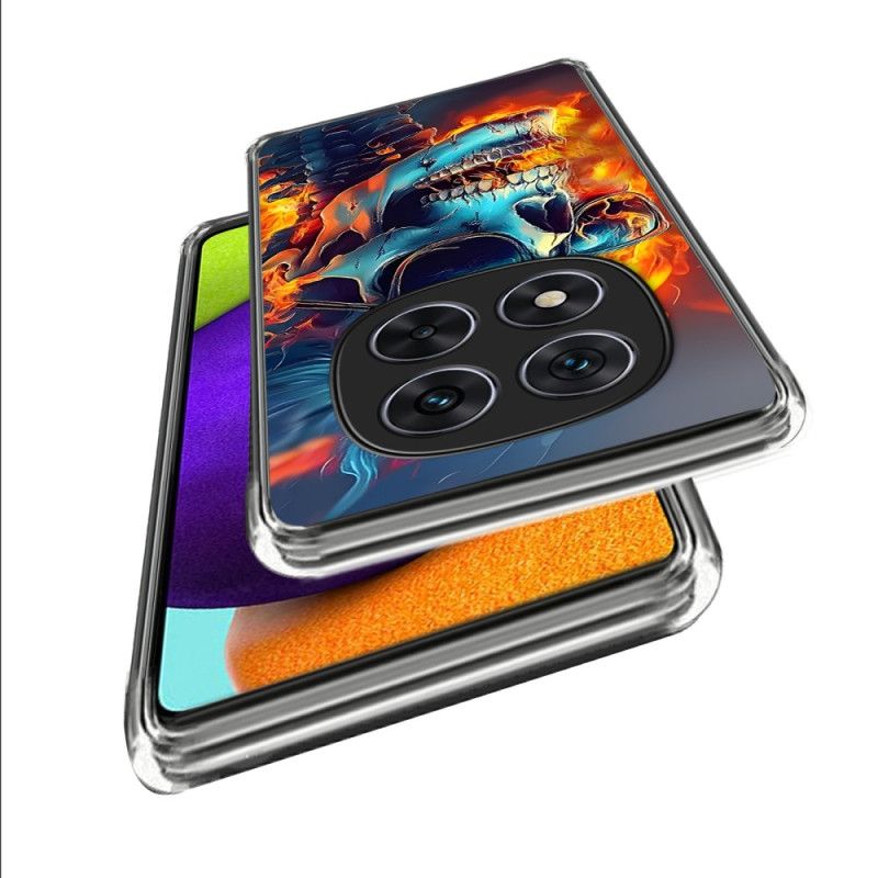 Deksel Xiaomi Redmi Note 14 Pro 4g Flammende Hodeskalle Beskyttelse Deksel